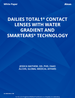 Dailies Total1® Contact Lenses With Water Gradient And Smartears® Technology